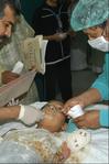 Armloze Iraakse jongen geopereerd