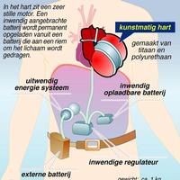 Volgend jaar robothart